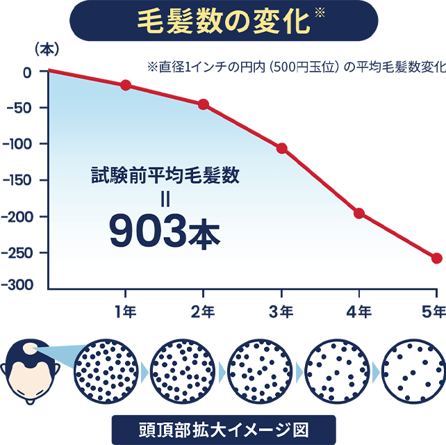 AGAの毛髪数の変化