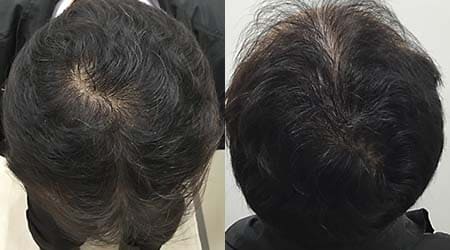 症例1：アフター