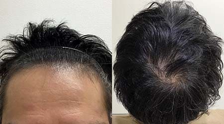 症例3：アフター