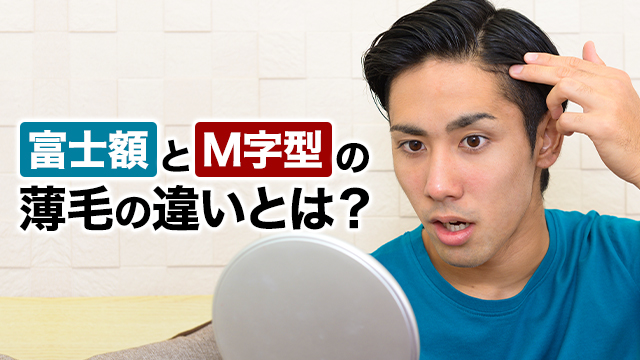 富士額とM字型の薄毛の違いとは？