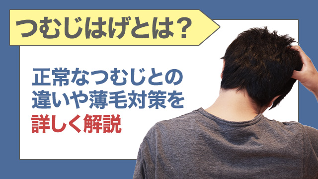 つむじハゲとは？正常なつむじとの違いや薄毛対策を詳しく解説