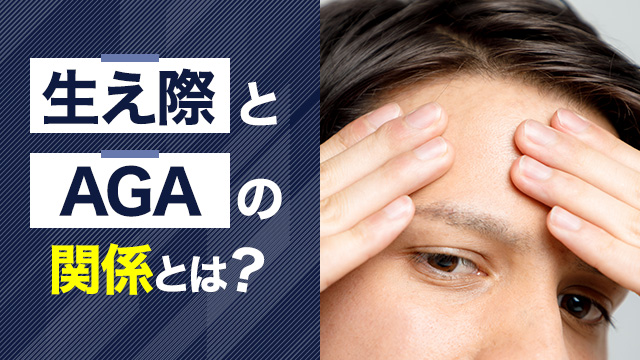 生え際とAGAの関係とは？