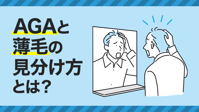 AGAと薄毛の見分けかたとは？