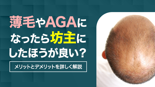 薄毛やAGAになったら坊主にしたほうが良い？